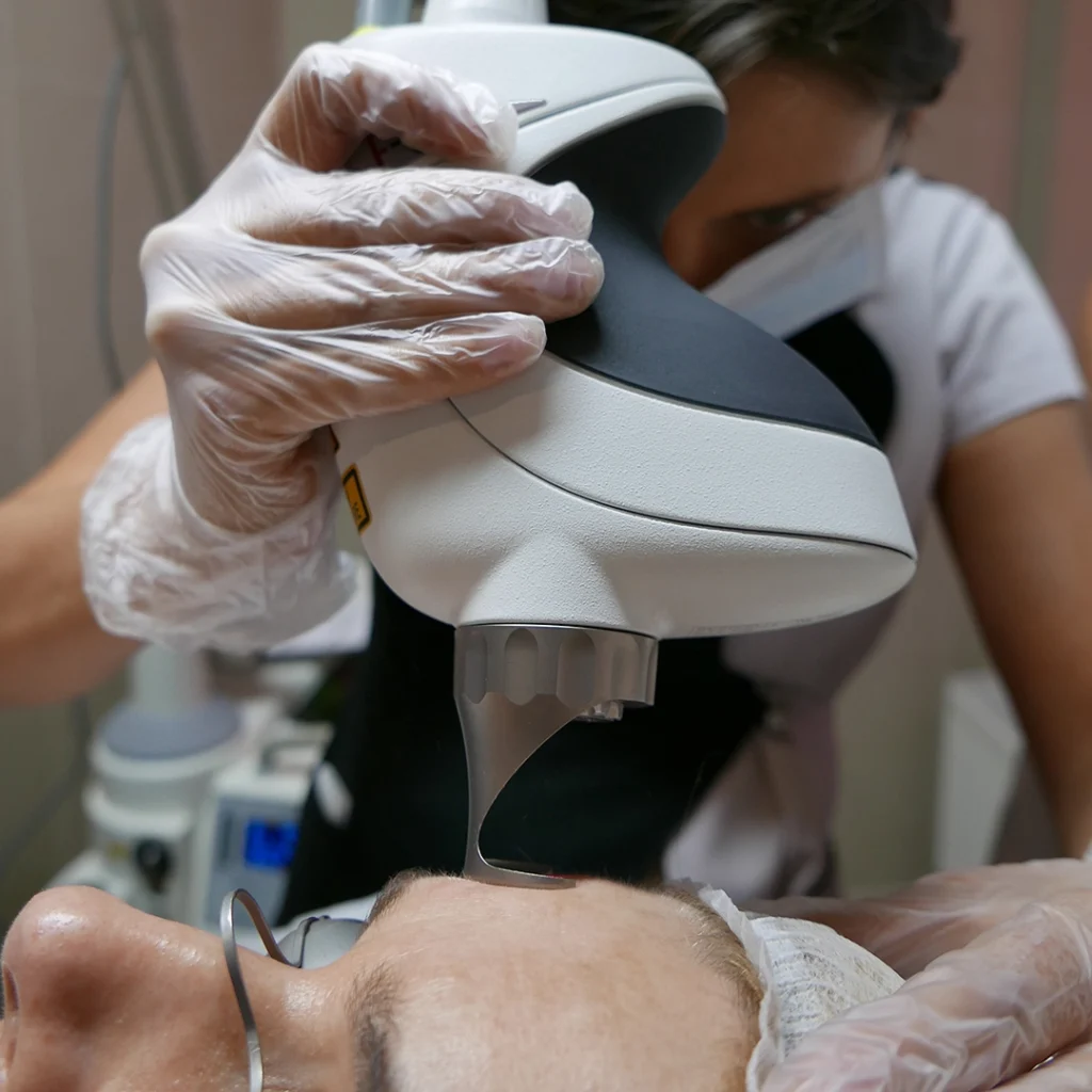 Frakcyjny laser ablacyjny leczneie bllizn